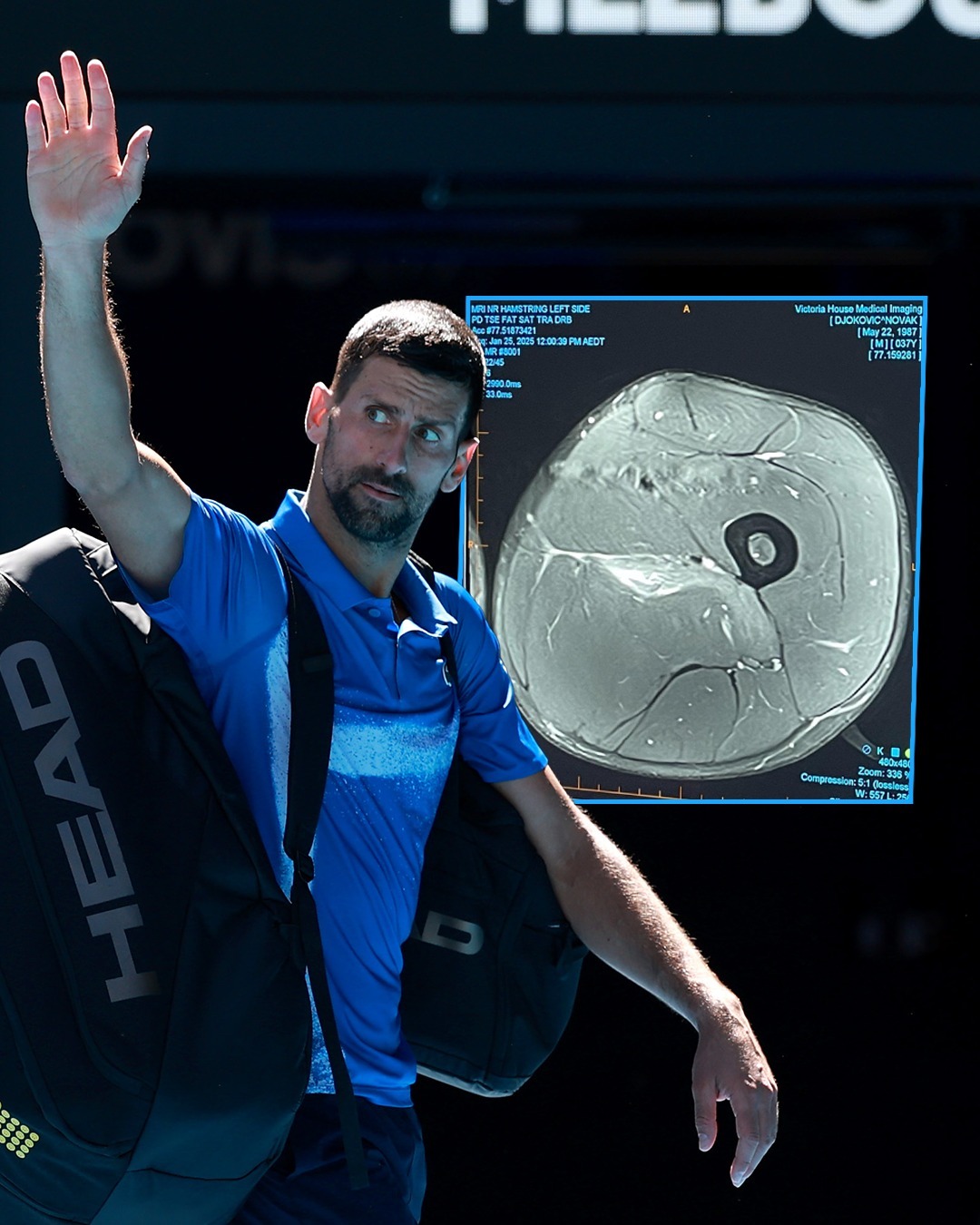 开云体育平台APP-包含美国网球队力克西班牙网球队，德约科维奇绝境逆转的词条